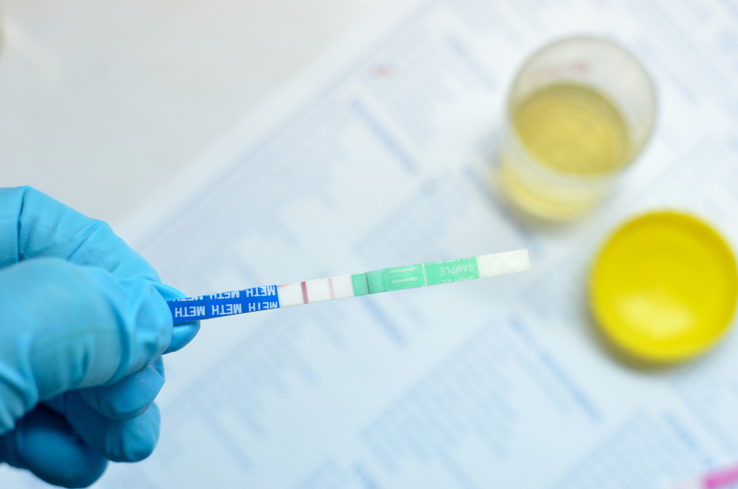 Faint Line on Drug Test: What It Means and How to Interpret It